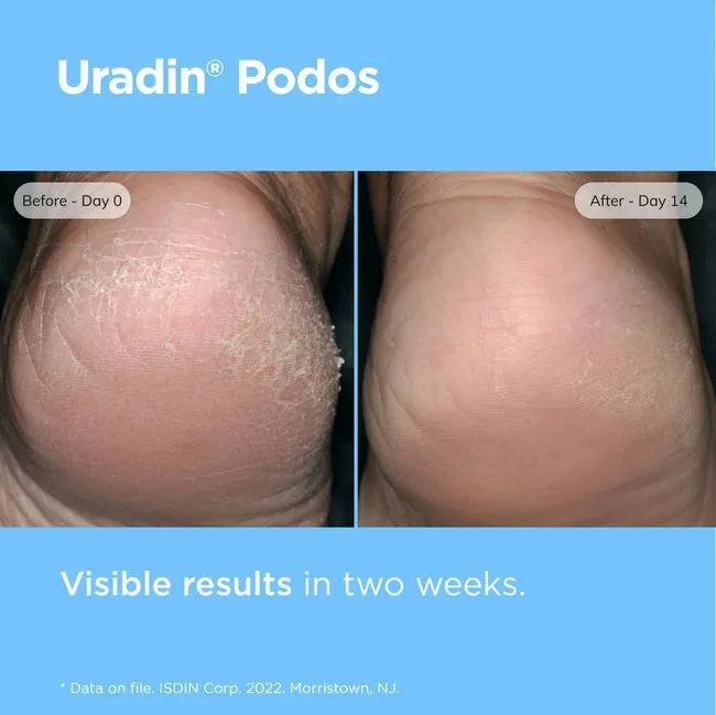 ISDIN Uradin Podos Gel Oil