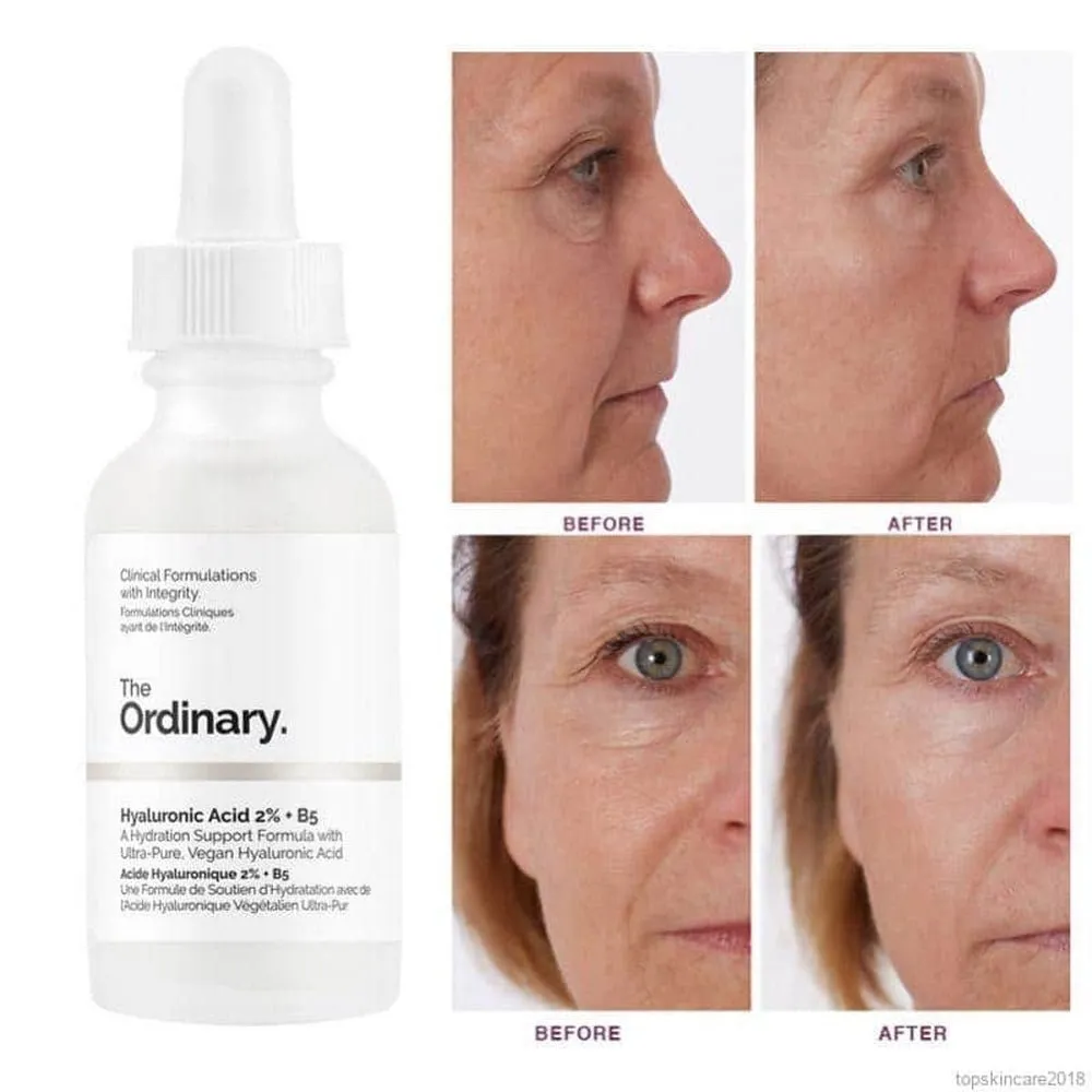 The Ordinary Hyaluronic Acid 2% B5 2% 30ml